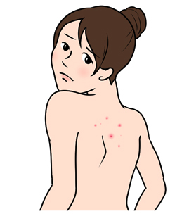 背中の状態が悪い