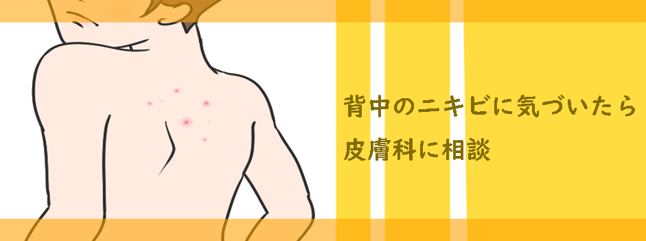 背中のニキビに気づいたら皮膚科に相談